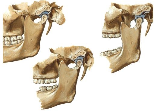 DTM e Dor Orofacial – Disfunção Temporomandibular (DTM) e Dor Orofacial